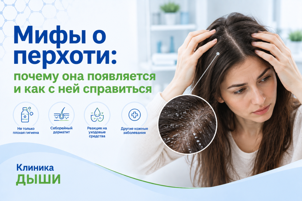 Мифы о перхоти: почему она появляется и как с ней справиться